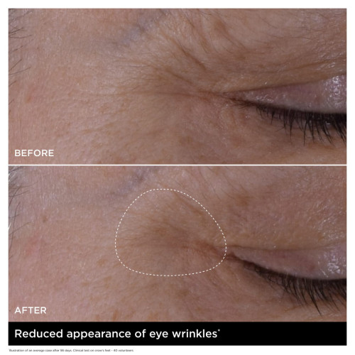Double Serum Eye